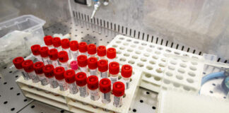 Coronavirus, Gallera: stiamo allargando la base per i tamponi.