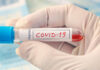 Coronavirus, test sierologici e tamponi presso Auxologico a Milano, Meda e Pioltello.