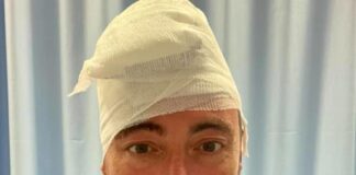 Incidente per Gallera, 30 punti alla testa.