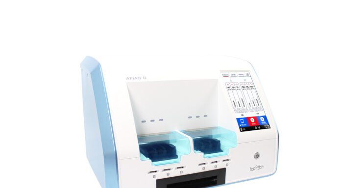 COVID-19: Menarini lancia il test antigenico che indica la carica virale.