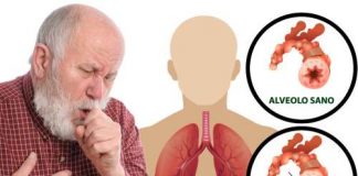 Malattie respiratorie, la campagna di Senior Italia FederAnziani: “Aiutiamo i pazienti a conoscere la patologia e a migliorare la qualità della vita”.