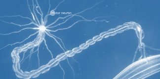 È ufficiale: il tofersen è il primo farmaco efficace in fase 3 nel trattamento della SLA.