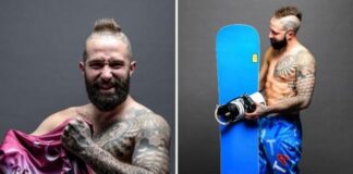 Atleta paralimpico lancia raccolta fondi per una protesi bionica: arriva il contributo di un ragazzo che aveva vissuto una situazione simile