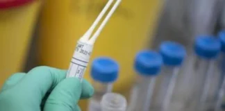 Legionella, focolaio in case popolari via Rizzoli, un morto
