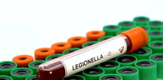 Focolaio legionella, Ats al lavoro
