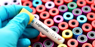 Allarme Legionella a San Siro: un morto e 8 ricoverati