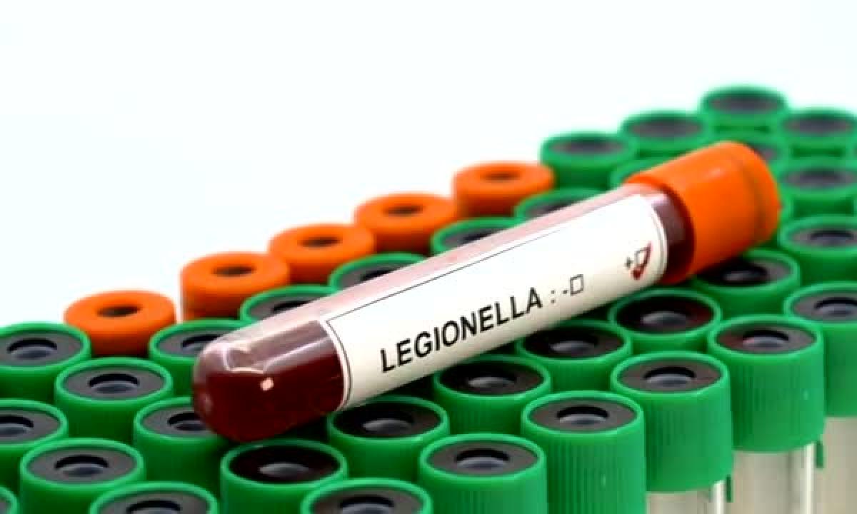 legionella