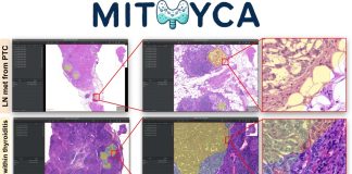 AI per diagnostica su tiroide, studio con Università Bicocca e IEO