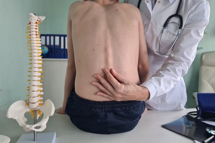 Orthopedist,Examines,Spine,And,Posture,And,Spinal,Deformities,Of,Teenage